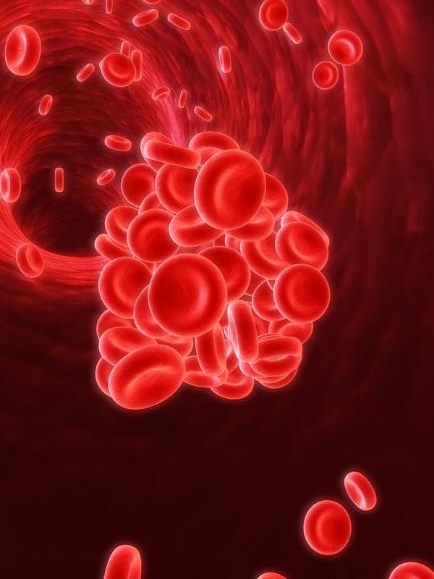 FDA chấp thuận thuốc mới trị bệnh đa hồng cầu