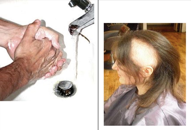 Rửa tay, nhổ tóc liên tục là dấu hiệu chỉ điểm của rối loạn ám ảnh cưỡng bức. Ảnh: TL