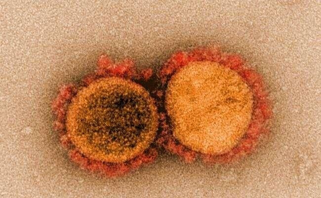 Sự truyền nhiễm của virus SARS-CoV-2 qua ống kính hiển vi điện tử.