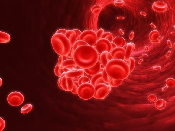 Đa hồng cầu dễ dẫn tới cục máu đông, nguy hiểm đến tính mạng.